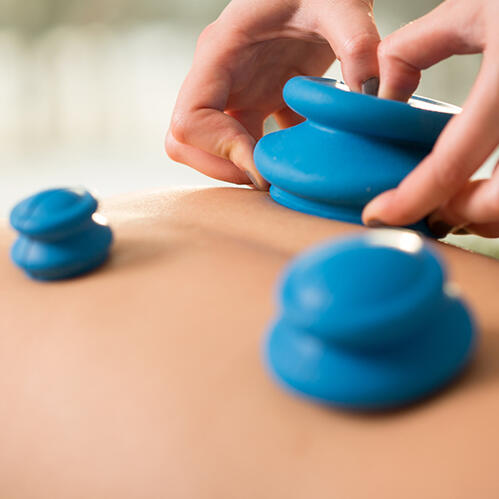 Cupping Massage